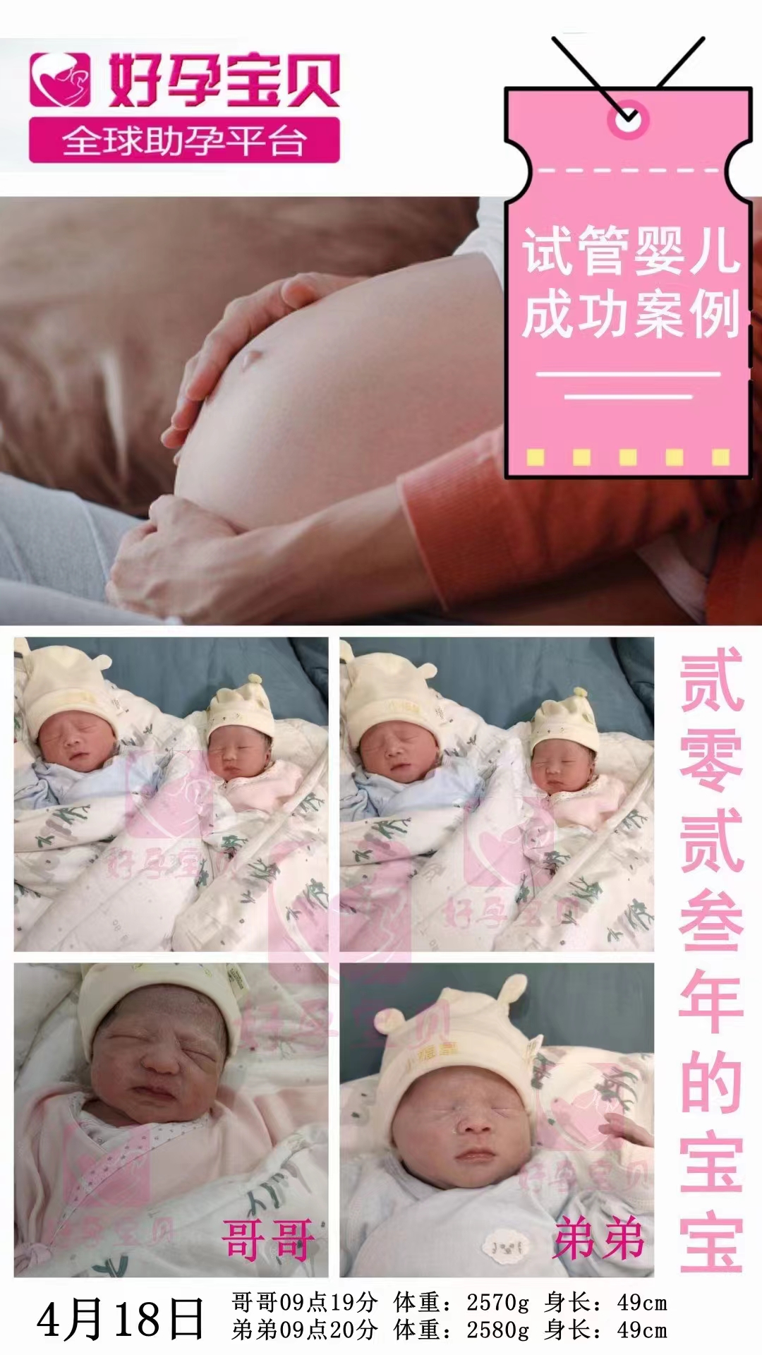 希宇助孕机构试管婴儿真相